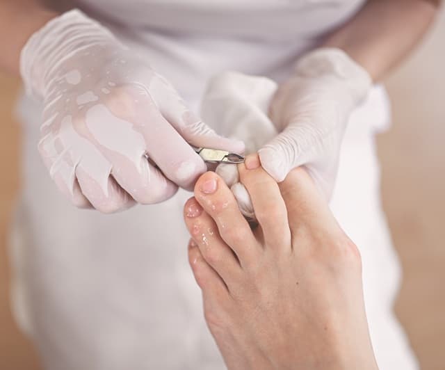 Podiatrist clipping toenails